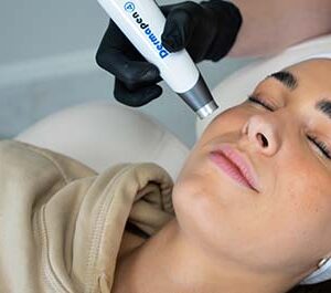 Dermapen