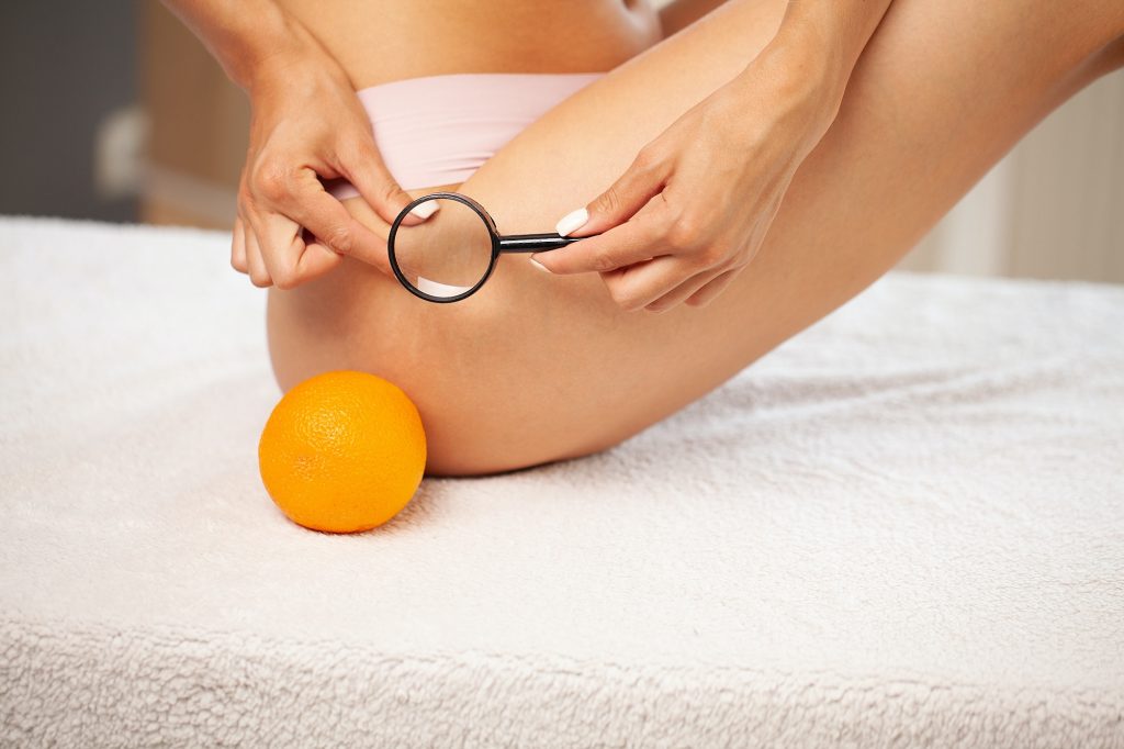 Woman Checking Cellulite On Her Buttock With Magnifying Glass