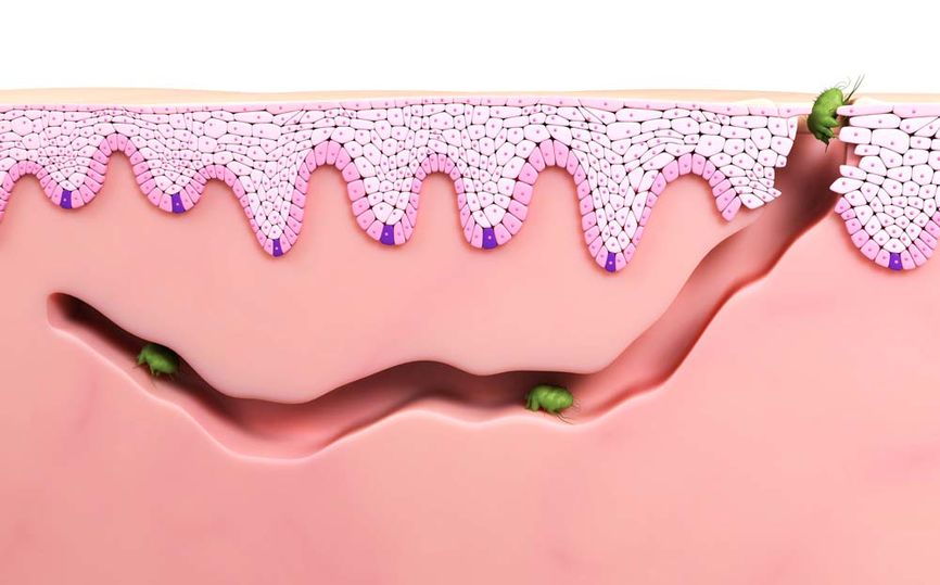 Huleganger der skabben graver og legger egg.