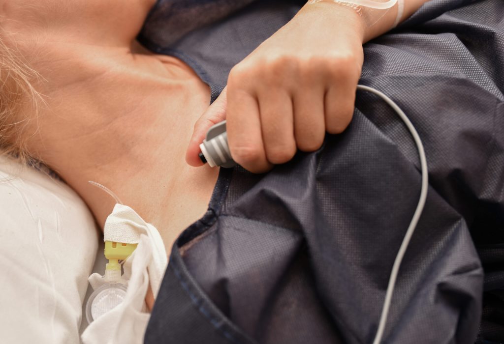 The woman presses the remote button for a regular dose of epidural anesthesia