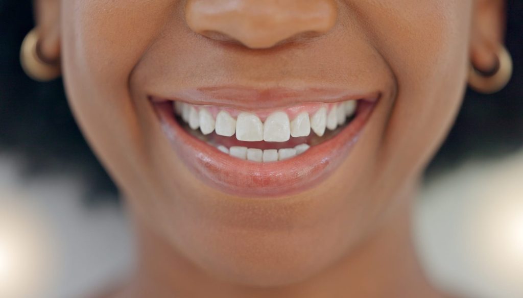 Closeup of smiling dentist showing white teeth with orthodontic invisible braces or a teeth whiteni